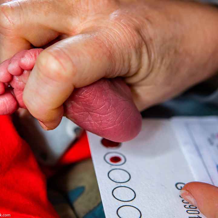 A newborn heel prick being performed.